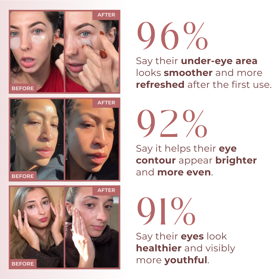Velunella Haloxyl Eye Patches