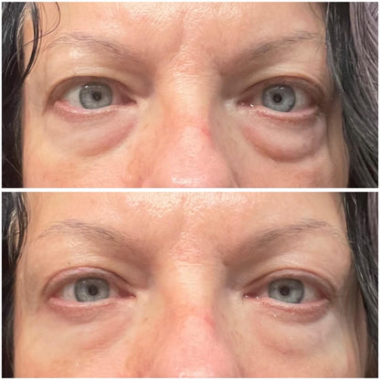 Velunella Haloxyl Eye Patches