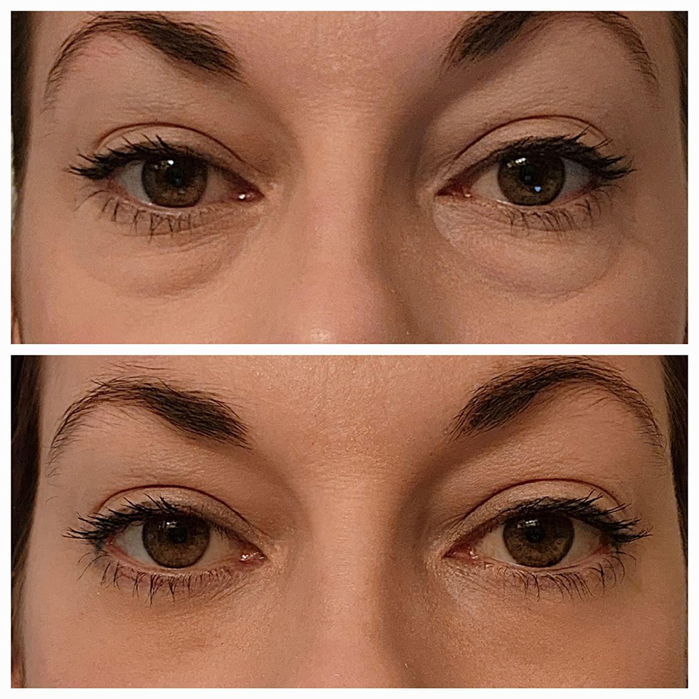 Velunella Haloxyl Eye Patches