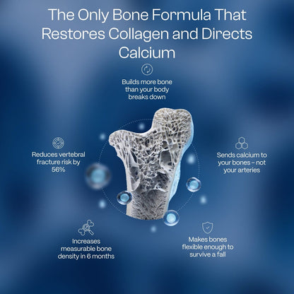Velunella Bones [01]